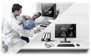 Nowy Ultrasonograf Samsung H60